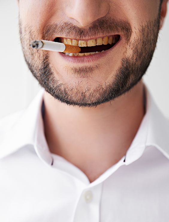 Smoking and Dental Health: How It Affects Your Teeth and Gums
